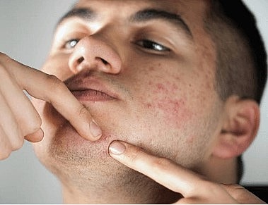 3 Things That Could Be Worsening Your Skin