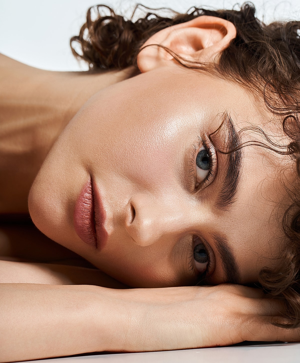 Rancho Santa Margarita Acne Scar Treatment model with curly hair.