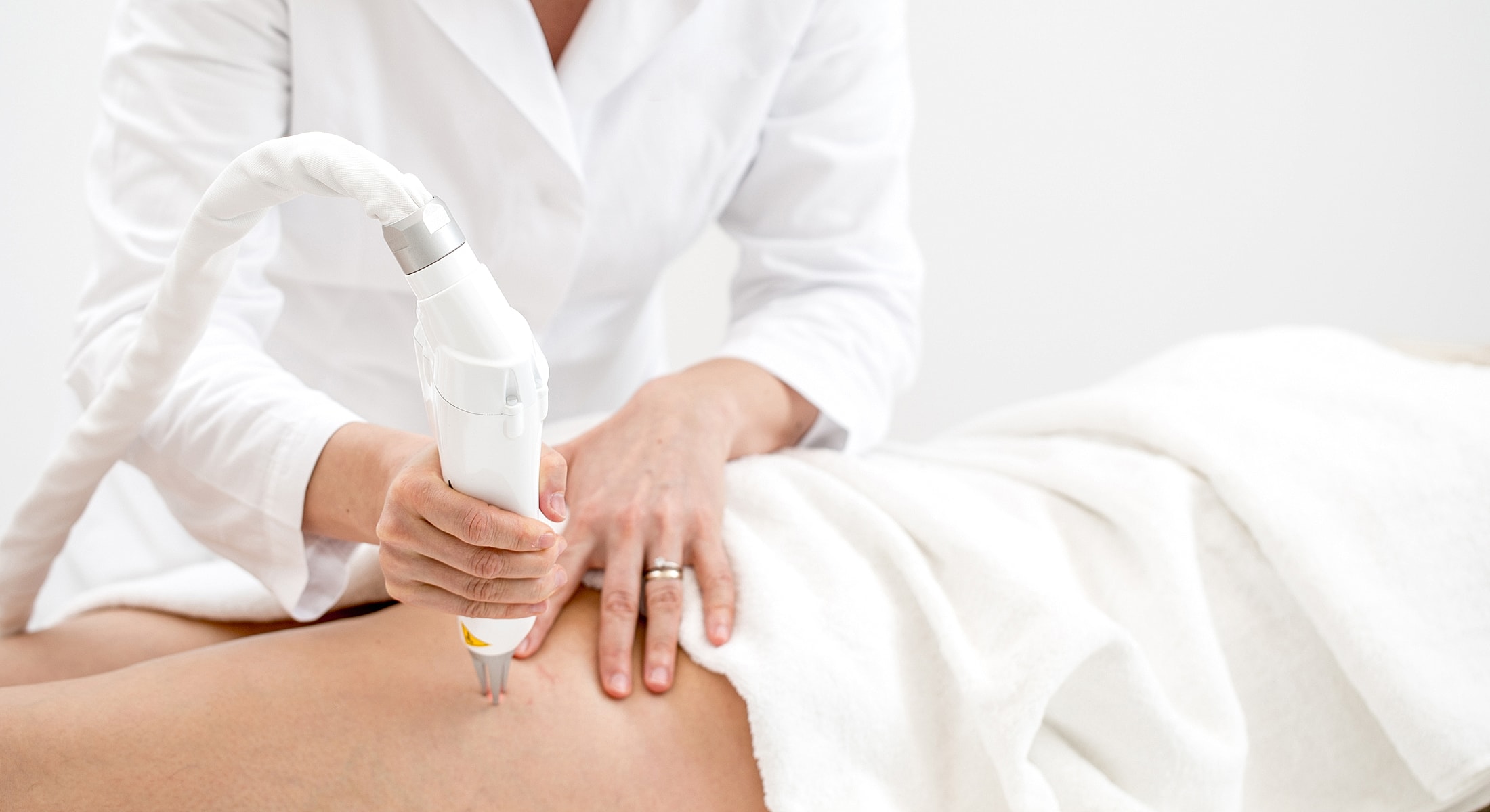 Rancho Santa Margarita laser vein treatment on a patient's thigh by clinician.